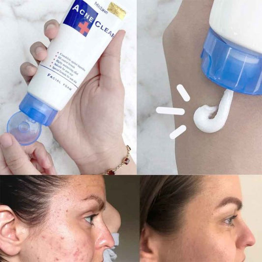 Mistine Acne Clear Face Wash
