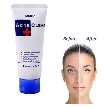 Mistine Acne Clear Face Wash